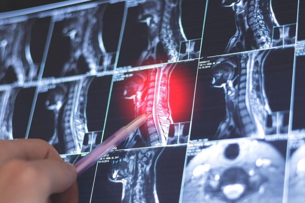 clinical and imaging assessment for degenerative disc disease in Singapore.