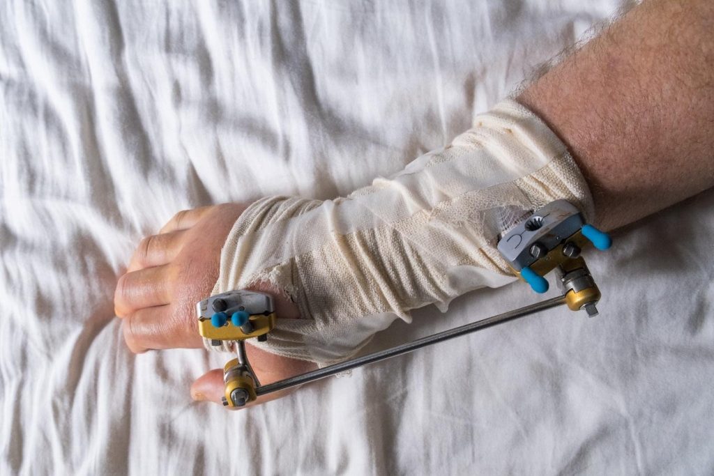 invasive and minimally invasive fracture fixation procedures in Singapore.
