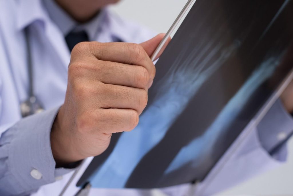 pre-surgical assessment for fracture fixation in Singapore.